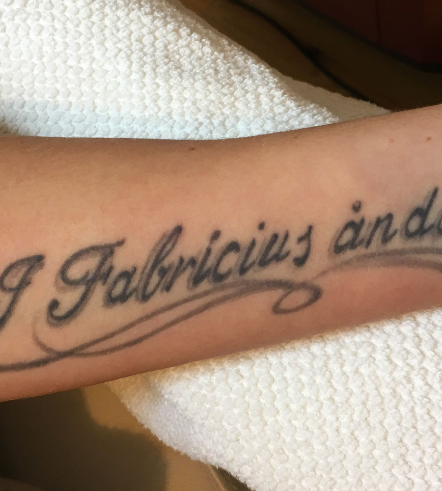 Før behandling — profil